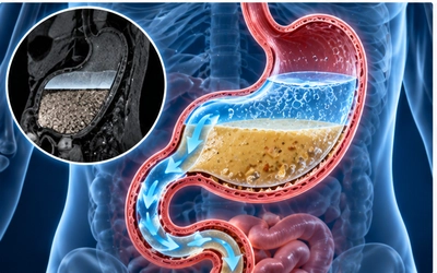 A Tale of Gastric Layering and Sieving: Gastric Emptying of a Liquid Meal with Water Blended in or Consumed Separately